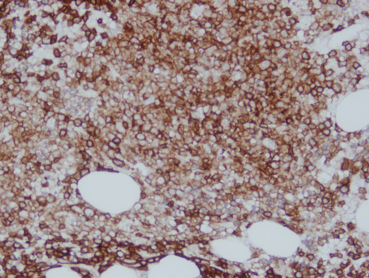CD43